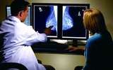 新型乳腺摄影术可使X光辐射剂量降低25倍 分辨率提高3倍