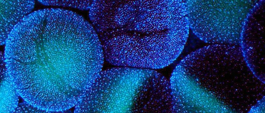 透过“现象”看“本质”：拉曼光谱解密细胞内结冰如何影响细胞活性！