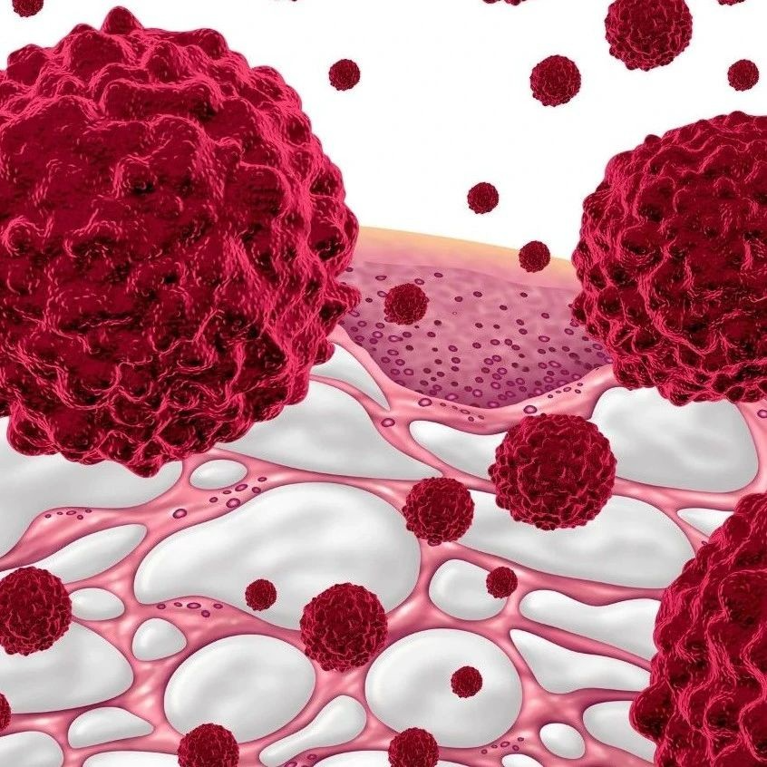 <b>为何有些疗法对癌症患者无效？Nature：揭示免疫细胞检测癌细胞突变并对其产生</b>