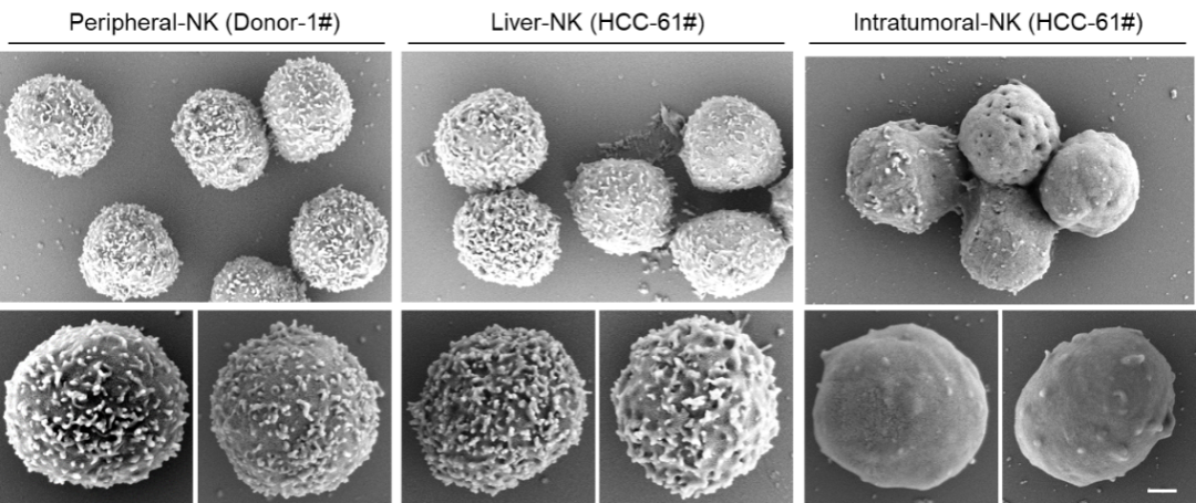 <b>Nature子刊：中国科学技术大学发现NK细胞失去抗癌功能新机制</b>