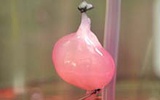 人造器官：实验室造出具有功能的肾脏