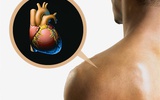 心脏病患者自身皮肤细胞可转化为心肌细胞修复受损心脏