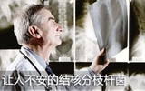 赛诺菲加入全球结核药物开发联盟的合作框架