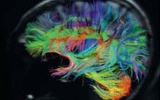 科学家实验室制造模拟大脑：具备基本自我意识