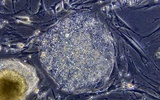 干细胞：21世纪生命科学领域最具发展前景的技术