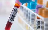 科学家在血液中发现一种生物标志物，可以更准确地预测死亡