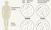 AI版“滴血测癌”！Nature：检测血液中微生物DNA，癌症早诊断