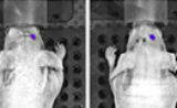 中科院合肥研究院恶性脑胶质瘤分子病因研究取得进展 | Cancer Research