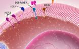 常见肿瘤基因检测规范及进展：乳腺癌HER2