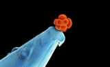 Nature：首次！科学家利用CRISPR-Cas9，成功实现单基因遗传病的突变基因安全修复