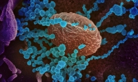Nature子刊：科学家首次绘制出人体对新冠病毒的免疫反应图谱