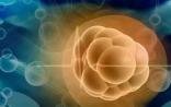 Nature子刊：能杀死癌细胞的“铁死亡”疗法是怎么一回事？