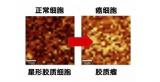 石墨烯又炫技，无创也能检测癌细胞