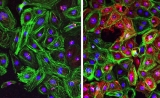 Sci Adv：研究人员使用CRISPR-Cpf1治疗杜氏肌营养不良