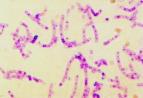 CDC生物研究中心尝试种新途径来杀死炭疽杆菌