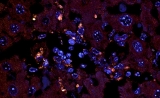 Science：肠道细菌也“作恶”——引发自身免疫疾病