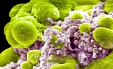 另辟蹊径：研究人员通过靶向休眠细胞对抗癌症复发| Nature 聚焦