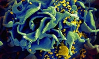 Nature：艾滋病能自愈？科学家从0.5%的患者身上找到了突破点