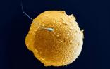 为什么胚胎时期人类就形成生殖细胞，而珊瑚、植物却不这样？| Plos Biology