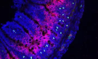 Cell：肠道感染最终引发慢性疾病，这与肠神经元、巨噬细胞密切相关！