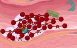 PLOS ONE：日科研人员发明血友病基因疗法 动物试验获成功