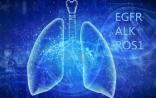 倾听肺癌临床新诉求：EGFR/ALK/ROS1(EAR)同步检测（技术篇）