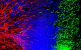 福音！3D打印肌腱、韧带，有望改变传统治疗方式
