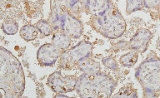 Science子刊挑战传统观点：ROS到底是促发还是抑制先兆子痫