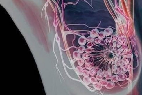还在纠结要不要做乳腺癌筛查？乳腺癌筛查可降低60%的死亡风险