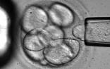 Stem Cell Res：日本研发出大量培养高质量干细胞新法