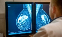对抗三阴乳腺癌化疗耐药性，MPS1靶点新药“重振”紫杉醇功效