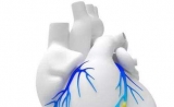 独角兽数字健康公司HeartFlow获得日本心脏诊断技术的报销批准