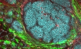 重要发现！Science揭秘癌细胞如何“废物利用”后加速生长，有望开发新疗法