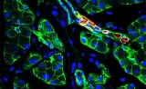 Molecular Therapy：重编程胰腺导管细胞，成功治疗糖尿病小鼠