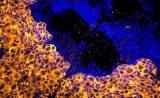 Cell子刊揭示：遏制恶性脑瘤的关键酶