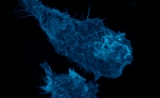 Science子刊：免疫细胞“呕吐”，阻止病原菌感染