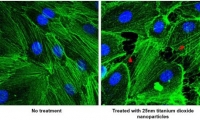 Nat Nanotechnol：本应杀死癌细胞的纳米颗粒实际上可能促进癌症转移