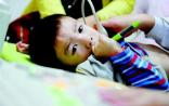 我国每年新增先天性心脏病患儿超过12万例
