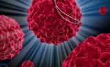 突破！Cell：新免疫疗法可治疗多种癌症，临床试验初步成功