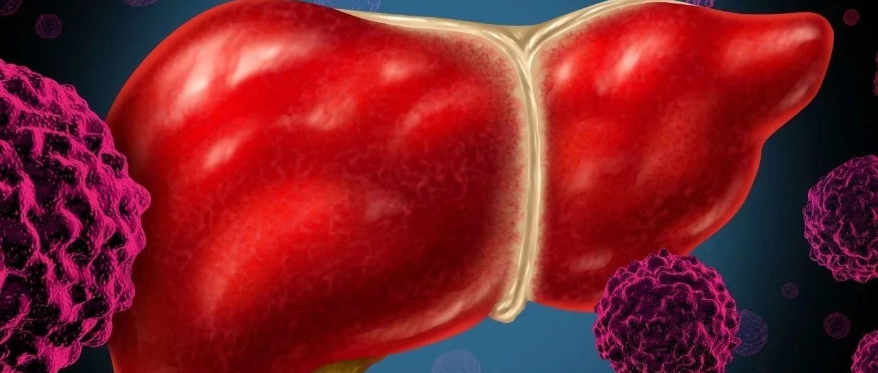 揭秘肝脂肪变性和肝纤维