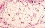 Cell Rep：脂肪如何变得致命？