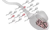 Nature子刊：评估后代患自闭症的风险，可以通过检测精子的突变实现