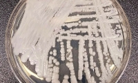 美国微生物学会年会2019：联合用药或能击败“超级真菌”