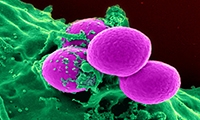 Cancer cell综述：免疫检查点抑制剂的临床挑战