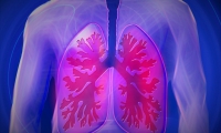 Nature：第一大癌症肺癌转移如何早发现？中国学者提供首个生化标志物