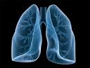 Nivolumab+Ipilimumab治疗非小细胞肺癌安全有效