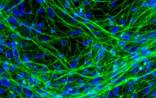 PNAS：一种天然产物有望减轻帕金森病