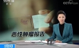 国家癌症中心：肺癌居恶性肿瘤发病第一位