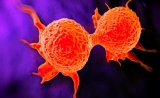 科学家提倡乳腺癌单细胞诊断