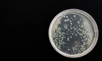 Nature：研究人员开发出可杀死多种耐药性细菌同时增强免疫的新型抗生素！